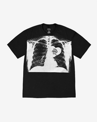 X-Ray Tee (Black)